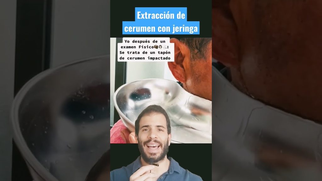 extracción de tapones compactos