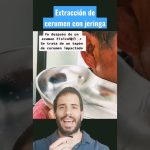 extracción de tapones compactos