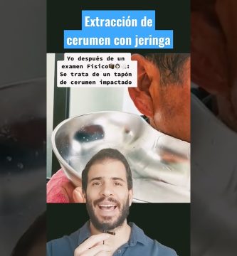 extracción de tapones compactos