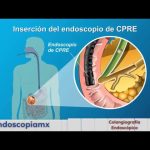 identificación de obstrucciones internas