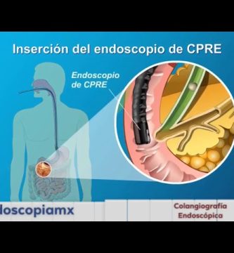 identificación de obstrucciones internas