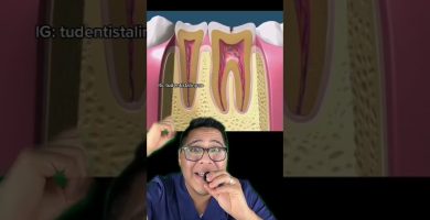 revisión de tuberías con crecimiento radicular